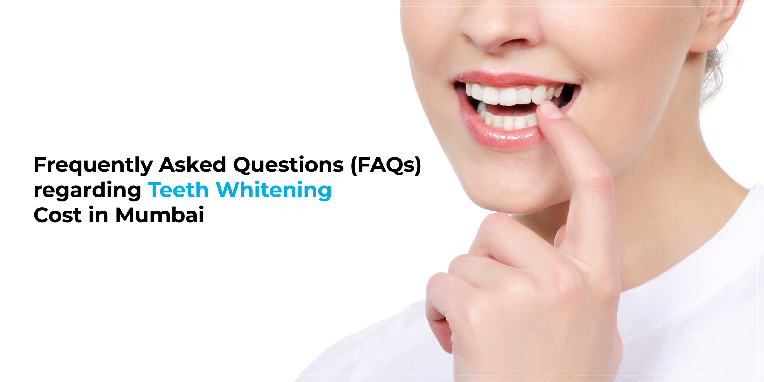 Frequently Asked Questions (FAQs) regarding Teeth Whitening Cost in Mumbai